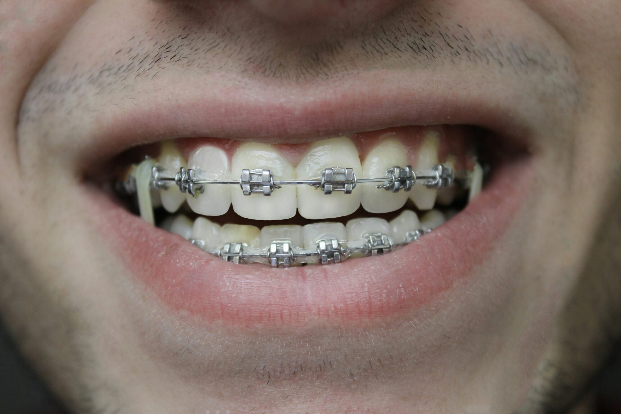 manhattan orthodontics